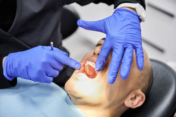 Best Emergency Tooth Extraction in Princeton, WV